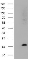m08736 1 anti cystatin sa cst2 mouse monoclonal antibody clone id oti5c2 wb testing 1