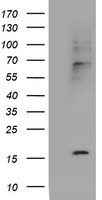 m08736 anti cystatin sa cst2 mouse monoclonal antibody clone id oti1d6 wb testing 1
