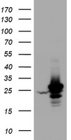 HEK293T cells were transfected with the pCMV6-ENTRY control (Left lane) or pCMV6-ENTRY HSD17B8 (Right lane) cDNA for 48 hrs and lysed