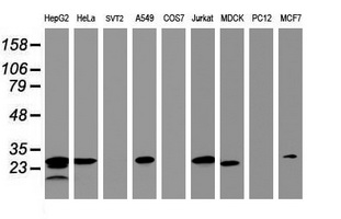 Western blot analysis of extracts (35ug) from 9 different cell lines by using anti-HSD17B8 monoclonal antibody (HepG2: human; HeLa: human; SVT2: mouse; A549: human; COS7: monkey; Jurkat: human; MDCK: canine; PC12: rat; MCF7: human)