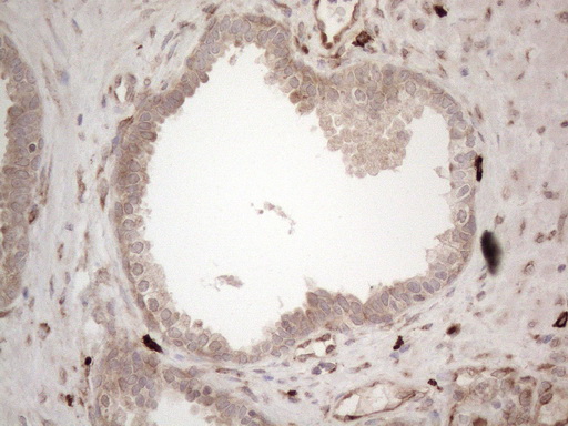 m08752 anti rbms1 mouse monoclonal antibody clone id oti2h1 ihc testing 11