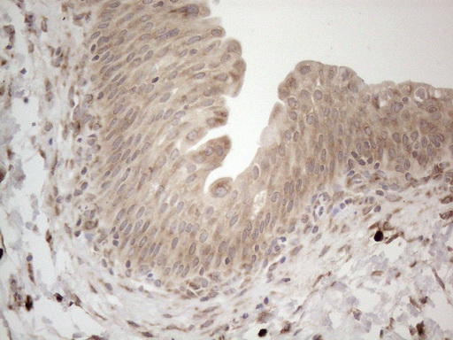 m08752 anti rbms1 mouse monoclonal antibody clone id oti2h1 ihc testing 12