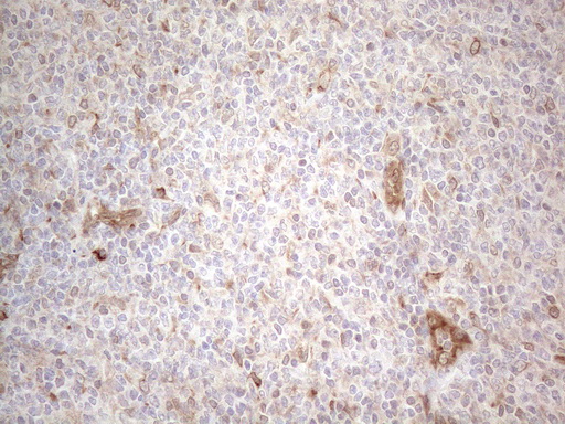 m08752 anti rbms1 mouse monoclonal antibody clone id oti2h1 ihc testing 14