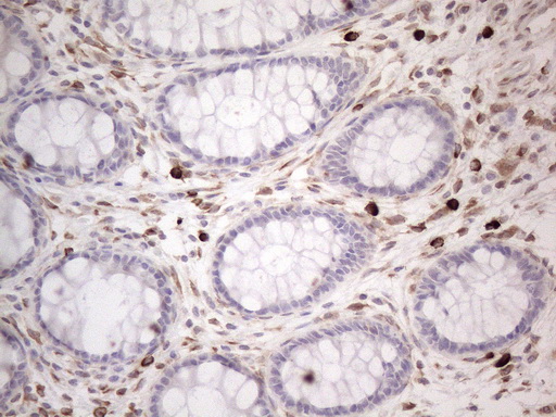 m08752 anti rbms1 mouse monoclonal antibody clone id oti2h1 ihc testing 16