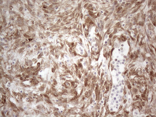 m08752 anti rbms1 mouse monoclonal antibody clone id oti2h1 ihc testing 17