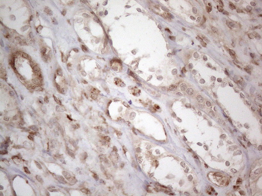 m08752 anti rbms1 mouse monoclonal antibody clone id oti2h1 ihc testing 18