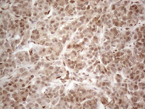 m08752 anti rbms1 mouse monoclonal antibody clone id oti2h1 ihc testing 20