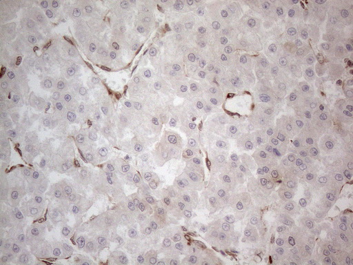 m08752 anti rbms1 mouse monoclonal antibody clone id oti2h1 ihc testing 21