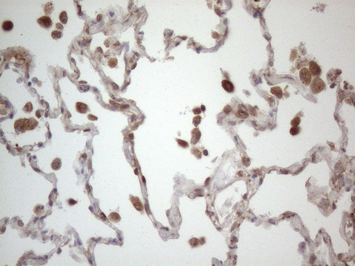 m08752 anti rbms1 mouse monoclonal antibody clone id oti2h1 ihc testing 22