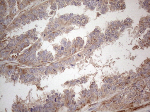 m08752 anti rbms1 mouse monoclonal antibody clone id oti2h1 ihc testing 3