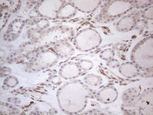 m08752 anti rbms1 mouse monoclonal antibody clone id oti2h1 ihc testing 5
