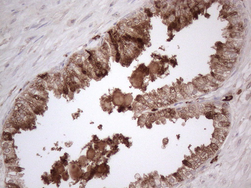 m08752 anti rbms1 mouse monoclonal antibody clone id oti2h1 ihc testing 9