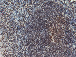 m08765 anti polr2e mouse monoclonal antibody clone id oti3b5 ihc testing 10