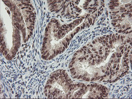 m08765 anti polr2e mouse monoclonal antibody clone id oti3b5 ihc testing 5