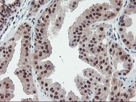 m08765 anti polr2e mouse monoclonal antibody clone id oti3b5 ihc testing 6
