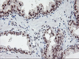 m08765 anti polr2e mouse monoclonal antibody clone id oti3b5 ihc testing 7