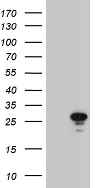 HEK293T cells were transfected with the pCMV6-ENTRY control (Left lane) or pCMV6-ENTRY MED19 (Right lane) cDNA for 48 hrs and lysed. Equivalent amounts of cell lysates (5 ug per lane) were separated by SDS-PAGE and immunoblotted with anti-MED19 (1:2000).