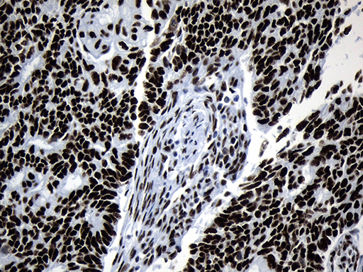 m08777 anti med19 mouse monoclonal antibody clone id oti2d1 ihc testing 10