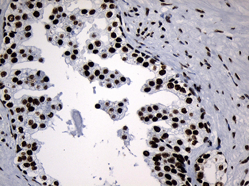 m08777 anti med19 mouse monoclonal antibody clone id oti2d1 ihc testing 11