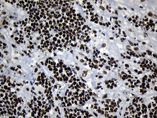 m08777 anti med19 mouse monoclonal antibody clone id oti2d1 ihc testing 12
