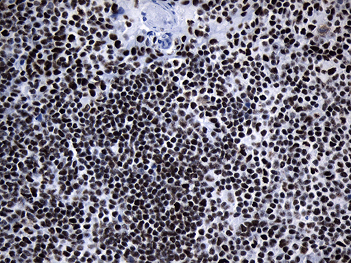 m08777 anti med19 mouse monoclonal antibody clone id oti2d1 ihc testing 13