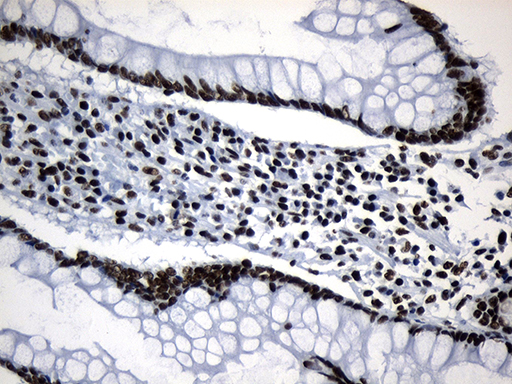 m08777 anti med19 mouse monoclonal antibody clone id oti2d1 ihc testing 14