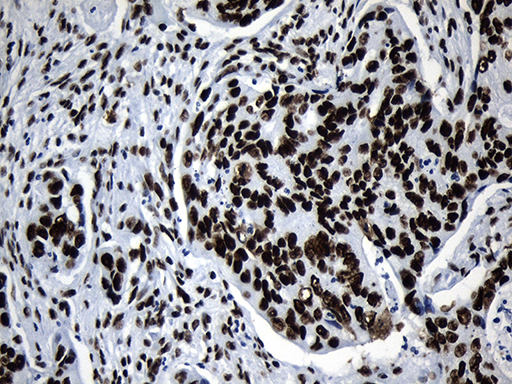 m08777 anti med19 mouse monoclonal antibody clone id oti2d1 ihc testing 15