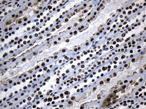 m08777 anti med19 mouse monoclonal antibody clone id oti2d1 ihc testing 16