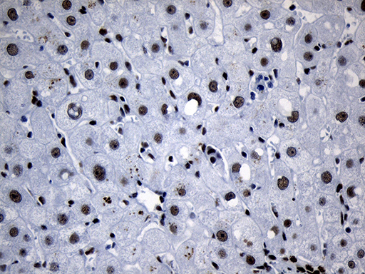 m08777 anti med19 mouse monoclonal antibody clone id oti2d1 ihc testing 17