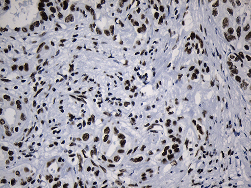 m08777 anti med19 mouse monoclonal antibody clone id oti2d1 ihc testing 18
