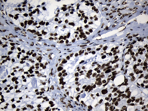 m08777 anti med19 mouse monoclonal antibody clone id oti2d1 ihc testing 4