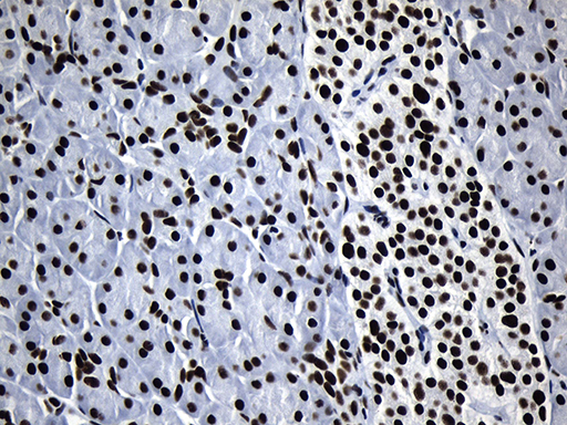 m08777 anti med19 mouse monoclonal antibody clone id oti2d1 ihc testing 5
