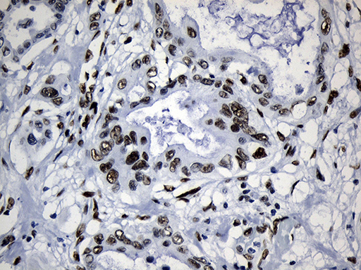 m08777 anti med19 mouse monoclonal antibody clone id oti2d1 ihc testing 6