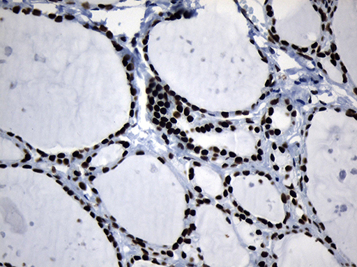m08777 anti med19 mouse monoclonal antibody clone id oti2d1 ihc testing 7