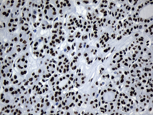 m08777 anti med19 mouse monoclonal antibody clone id oti2d1 ihc testing 8