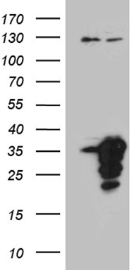 HEK293T cells were transfected with the pCMV6-ENTRY control (Left lane) or pCMV6-ENTRY MED19 (Right lane) cDNA for 48 hrs and lysed