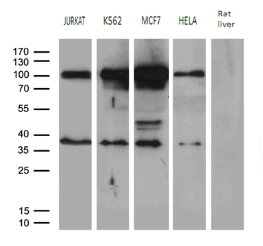 Western blot analysis of extracts (35ug) from 4 different cell lines and rat liver tissue lysate by using anti-MED19 monoclonal antibody (1:500)