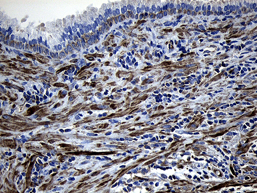 Immunohistochemical staining of paraffin-embedded Human prostate tissue within the normal limits using anti-MYL1 mouse monoclonal antibody
