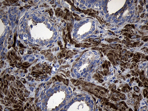 m08789 anti myosin light chain 1 myl1 mouse monoclonal antibody clone id oti4e3 ihc testing 4