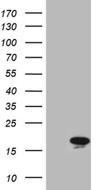 HEK293T cells were transfected with the pCMV6-ENTRY control (Left lane) or pCMV6-ENTRY MYL1 (Right lane) cDNA for 48 hrs and lysed