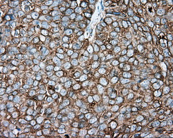 m08793 1 anti tuba8 mouse monoclonal antibody clone id oti2g6 ihc testing 3