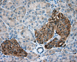 m08793 1 anti tuba8 mouse monoclonal antibody clone id oti2g6 ihc testing 4