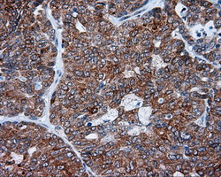 m08793 anti tuba8 mouse monoclonal antibody clone id oti3e10 ihc testing 4