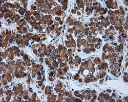 m08793 anti tuba8 mouse monoclonal antibody clone id oti3e10 ihc testing 6