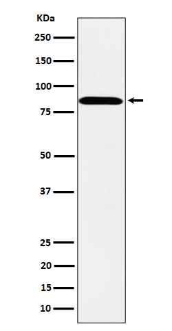 Western blot analysis of PPM1E expression in SH-SY5Y cell lysate