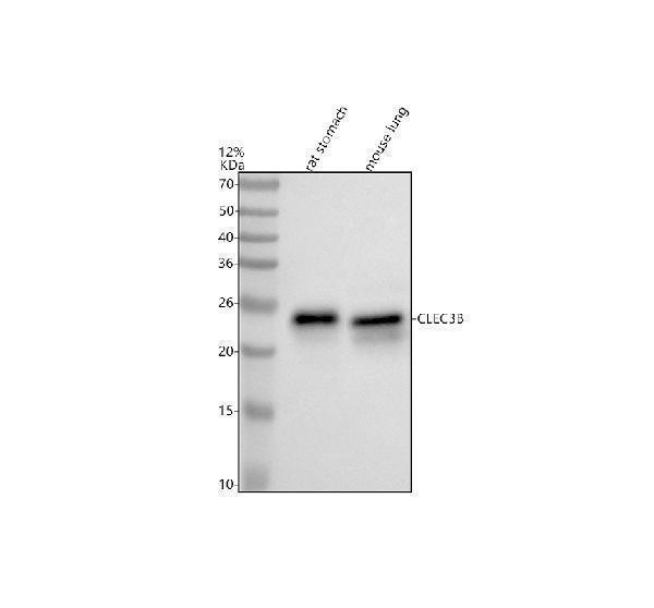 Western blot analysis of CLEC3B using anti-CLEC3B antibody (M08805-1)