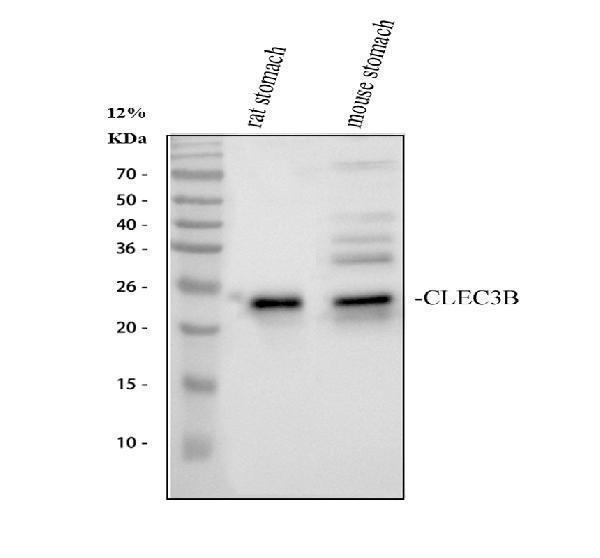 Western blot analysis of Tetranectin/CLEC3B using anti-Tetranectin/CLEC3B antibody (M08805-1)