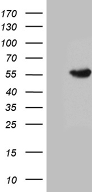 HEK293T cells were transfected with the pCMV6-ENTRY control (Left lane) or pCMV6-ENTRY SPOCK2 (Right lane) cDNA for 48 hrs and lysed