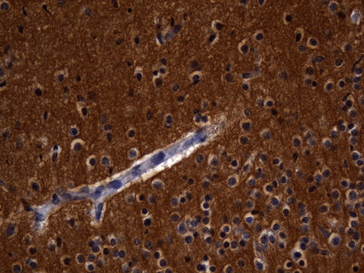 Immunohistochemical staining of paraffin-embedded Human adult brain tissue within the normal limits using anti-RGS17 mouse monoclonal antibody