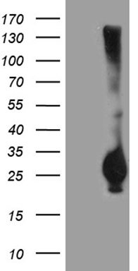 HEK293T cells were transfected with the pCMV6-ENTRY control (Left lane) or pCMV6-ENTRY RGS17 (Right lane) cDNA for 48 hrs and lysed